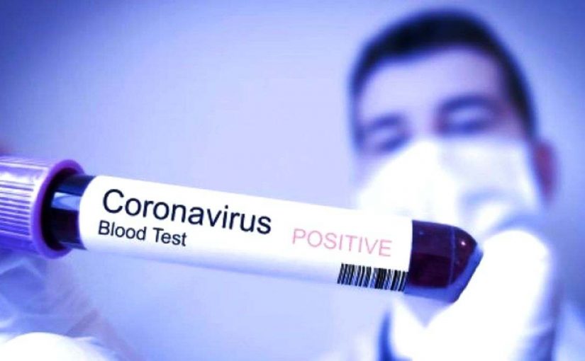 Khutbah Jumat: Menyikapi Virus Corona